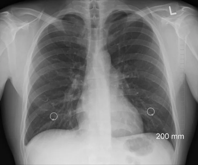 image-27