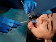 Terapia pulpar y materiales bioactivos