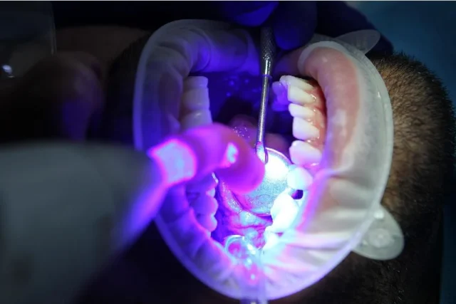 laser dental