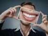 Implantes dentales para el odontólogo general