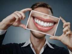 Implantes dentales para el odontólogo general